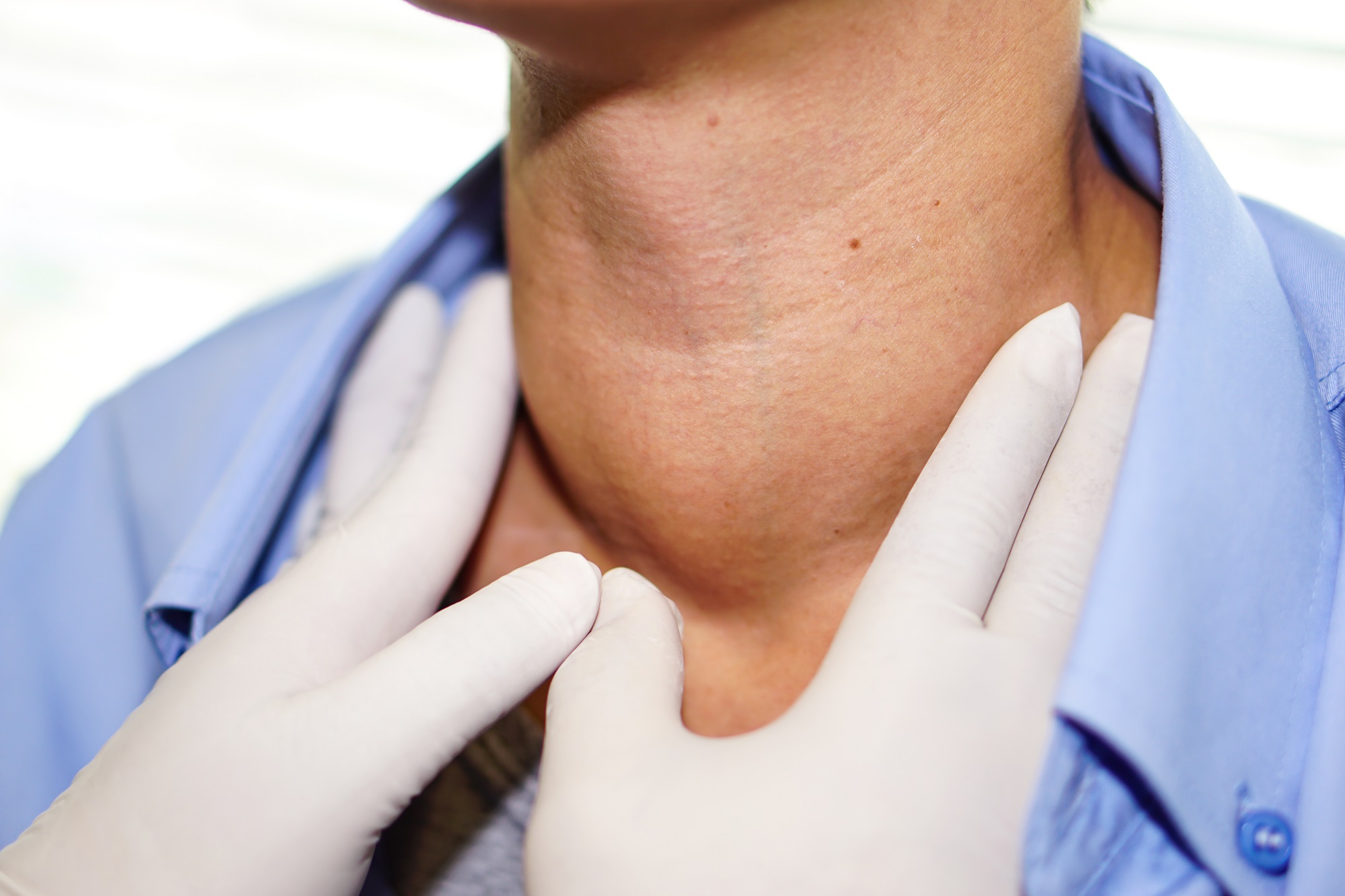 Thyroid Disorders